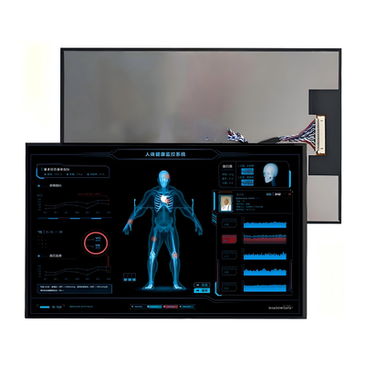 10Ecrã LCD TFT de 0,1 polegadas - Tela sensível ao toque de alta resolução para uso industrial e automotivo